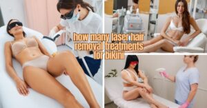 Read more about the article How Many Laser Hair Removal Treatments for Bikini: Best Guide